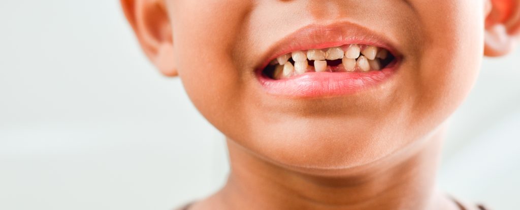 Kid with missing teeth