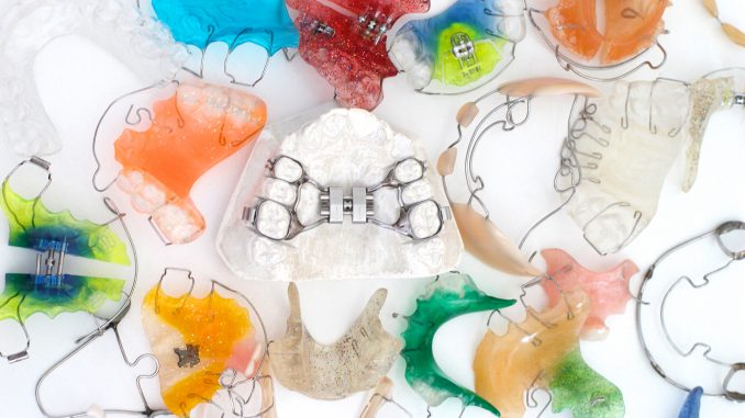 Different kinds of retainers