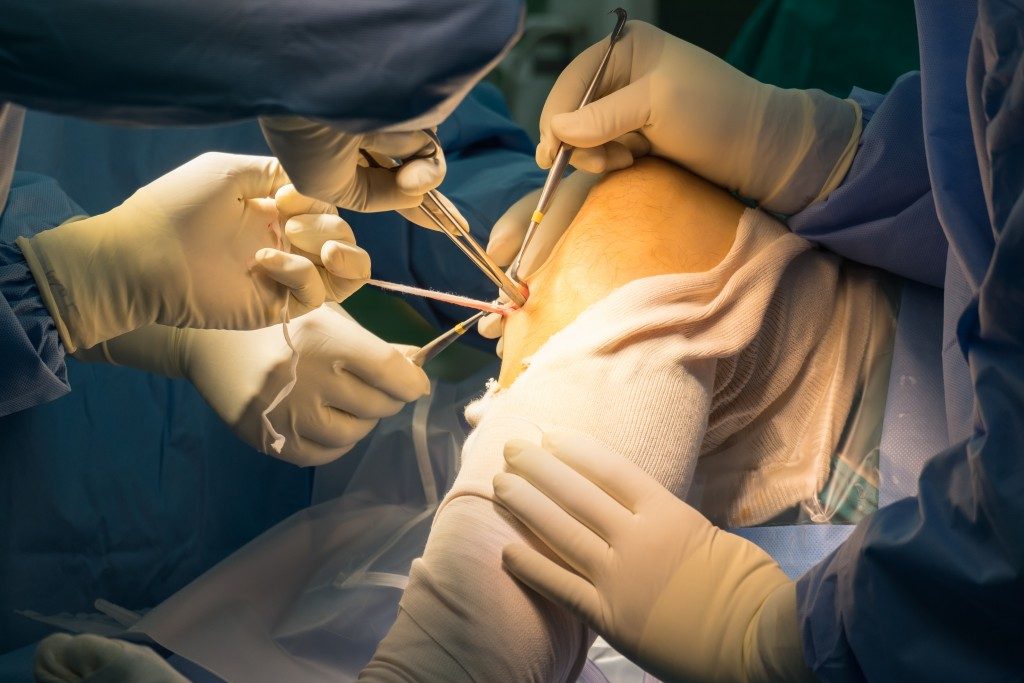 Surgery on the knee