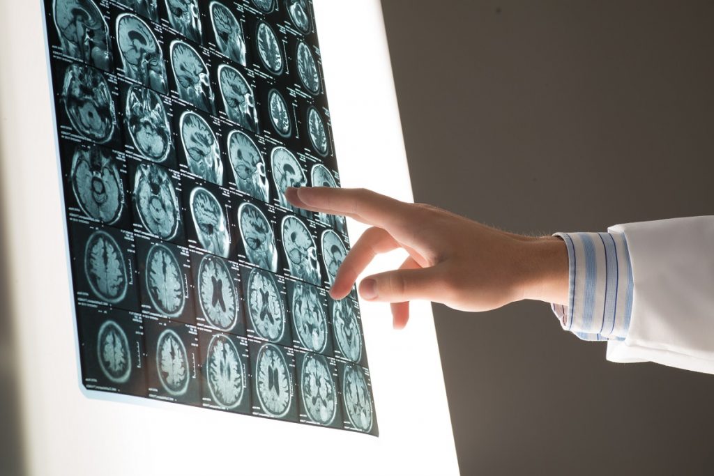 Doctor pointing at an x-ray