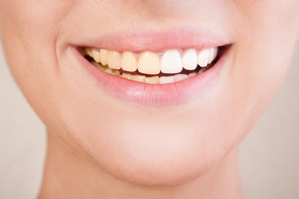 close up shot of woman's teeth