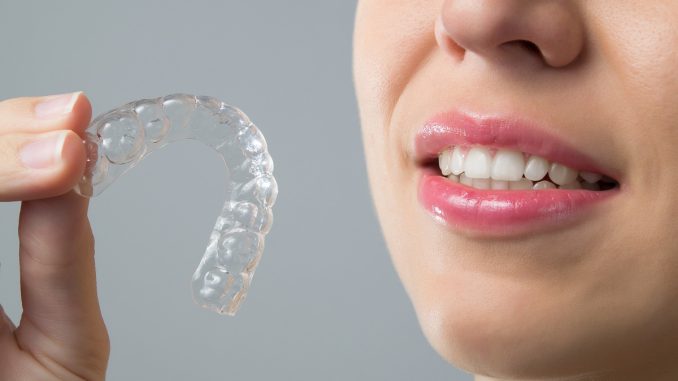 woman holding clear aligner